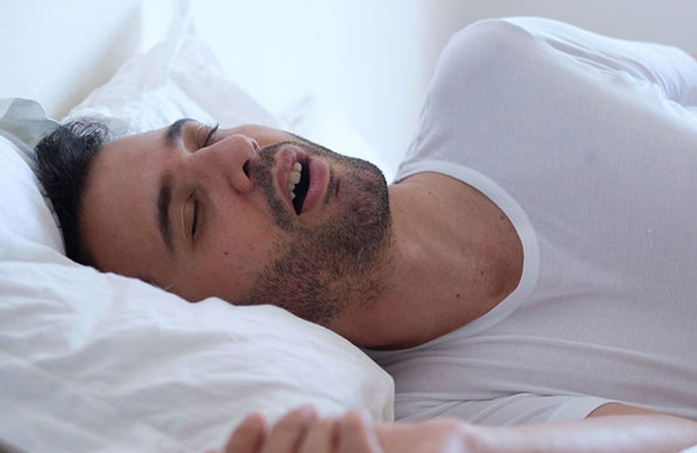 Sleep Apnea